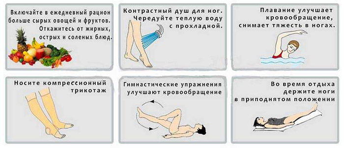 Профилактика варикоза на ногах в домашних условиях Профилактика варикоза на ногах в домашних условиях