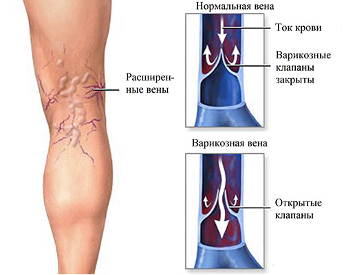 Какая кровь течет в венах малого круга кровообращения у птиц