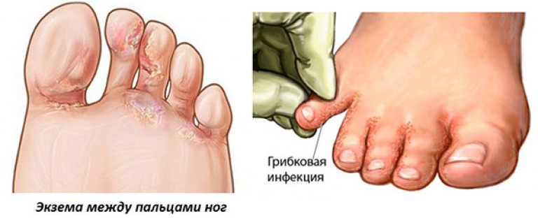 Пульс в губах что это Пульс в губах что это
