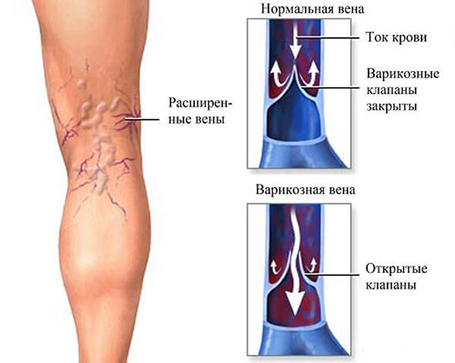 Продукты полезные для вен