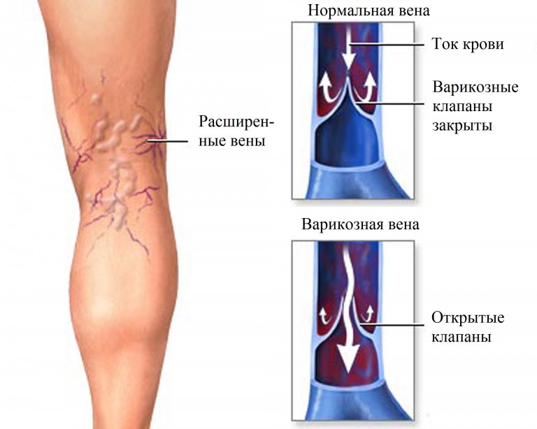 Анализ крови на гепатиты и вич