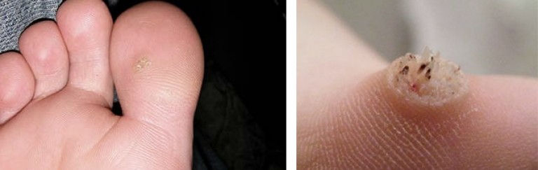 Как стать дизайнером одежды: 7 подсказок от профи Как обшить потолок пластиковыми панелями (фото)