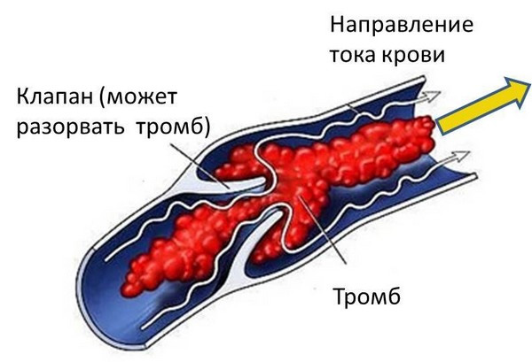Ноют ноги ниже колен: причины, способы лечения, профилактика Ноют ноги ниже колен: причины, способы лечения, профилактика