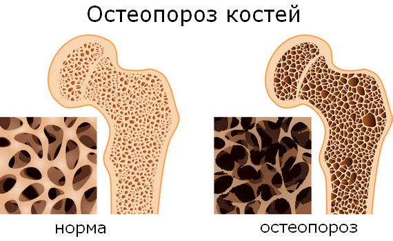 Ноют ноги ниже колен: причины, способы лечения, профилактика Ноют ноги ниже колен: причины, способы лечения, профилактика