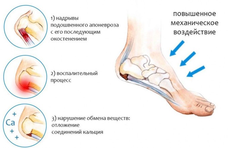 Гельминты реферат заключение