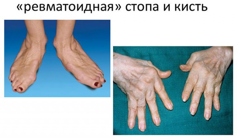 Крус, Пенелопа Википедия Красивые прически на средние тонкие волосы (50)