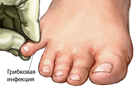 feel feet