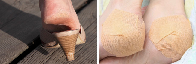 Повреждения кожи на ногах