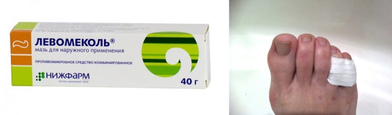 Мазь для гнойных воспалений. Мазь вишневского. Мазь от панариция на пальце. Мазь от панариция левомеколь. Мазь вишневского от гнойных воспалений.