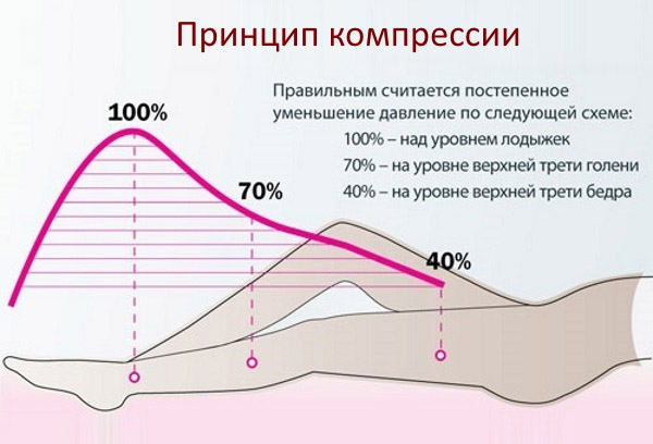 Варикозное расширение вен при беременности к какому врачу обратиться thumbnail