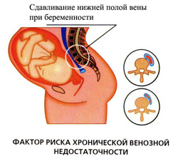 Причины заболевания