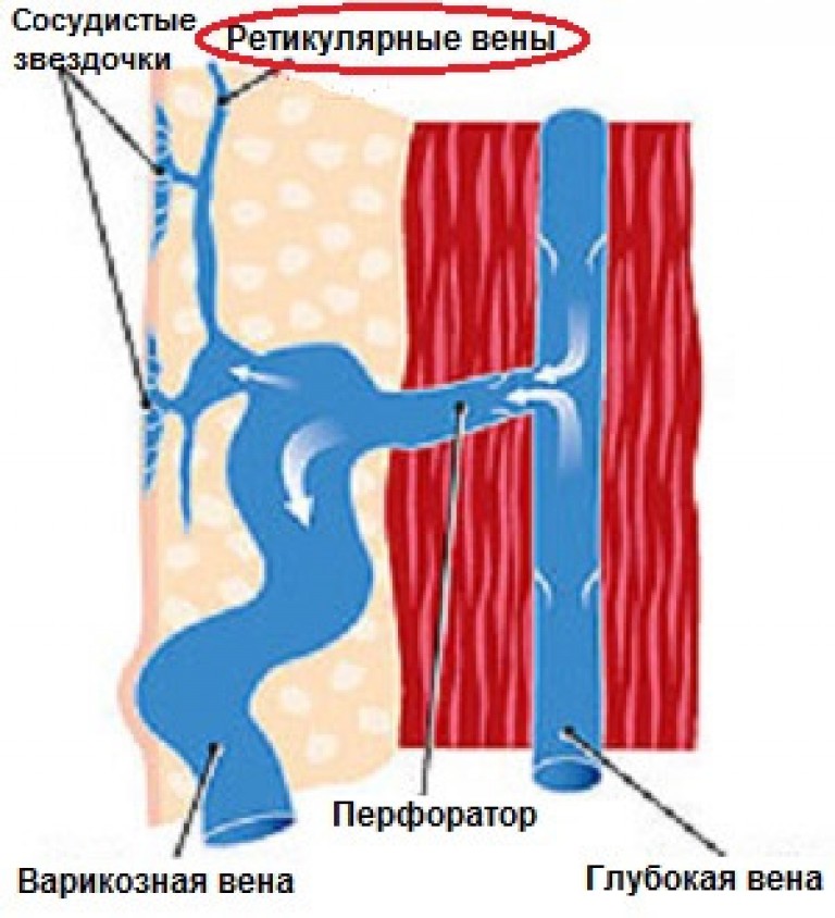 Выраженный венозный рисунок