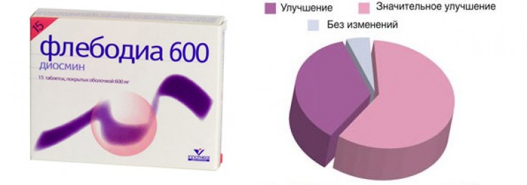 Лечение варикоза малого таза у женщин препараты схема лечения