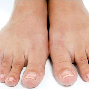 Как вылечить грибок на ногте большого пальца ноги