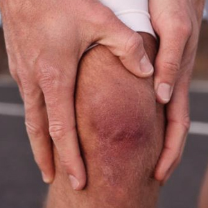 Что делать, если колено опухло и ощущается боль