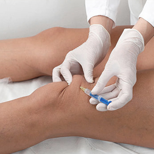 Обзор препаратов для инъекций при артрозе коленного сустава