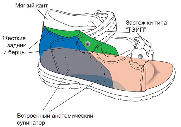 Правильный подбор обуви