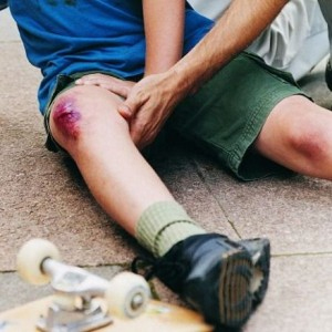 Ушиб при падении на коленный сустав