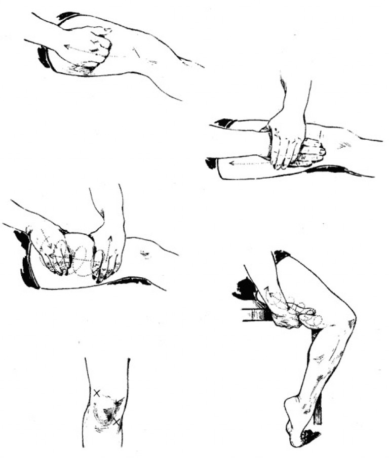 Самомассаж бедер. Самомассаж коленного сустава при артрозе. Массаж при артрозе коленного сустава техника выполнения. Самомассаж ног при артрозе коленного сустава. Самомассаж мышц голени.