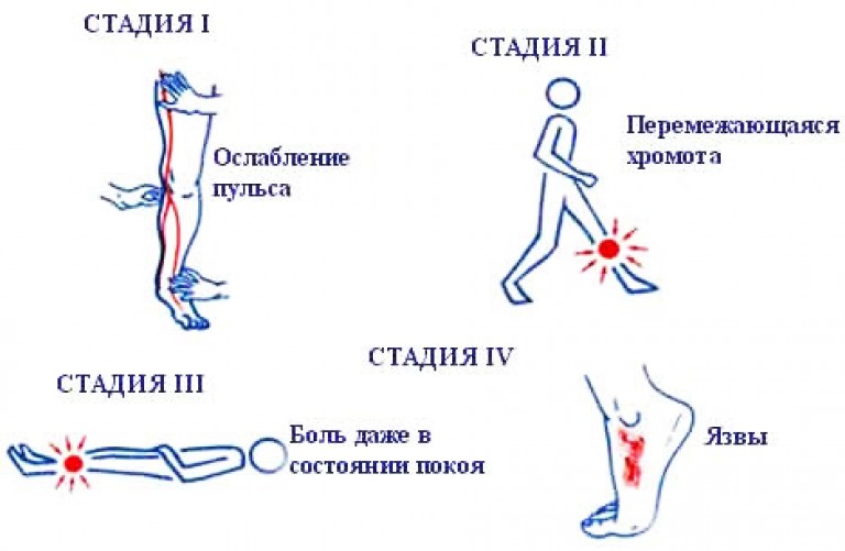 Трофические язвы мази для лечения заживляющая Shtampik.com