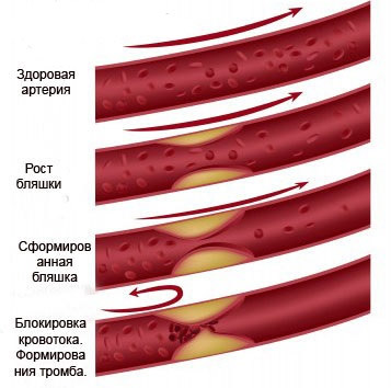 Процесс формирования тромба
