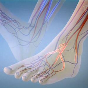 Способы укрепления сосудов и капилляров на ногах