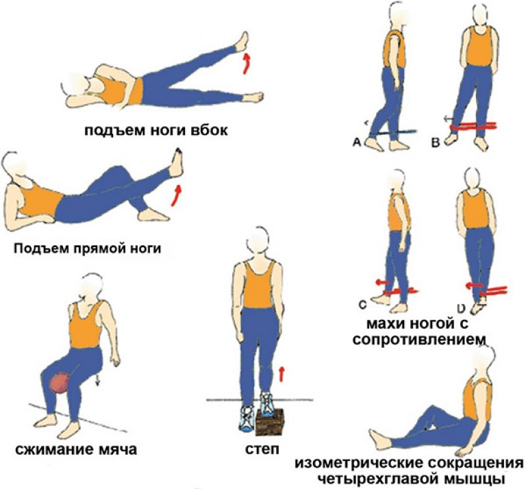 Связки на колене схема