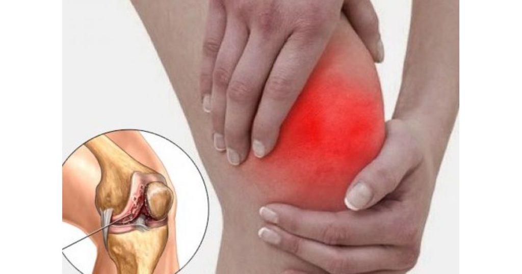 Лечение воспалительного процесса в суставе колена